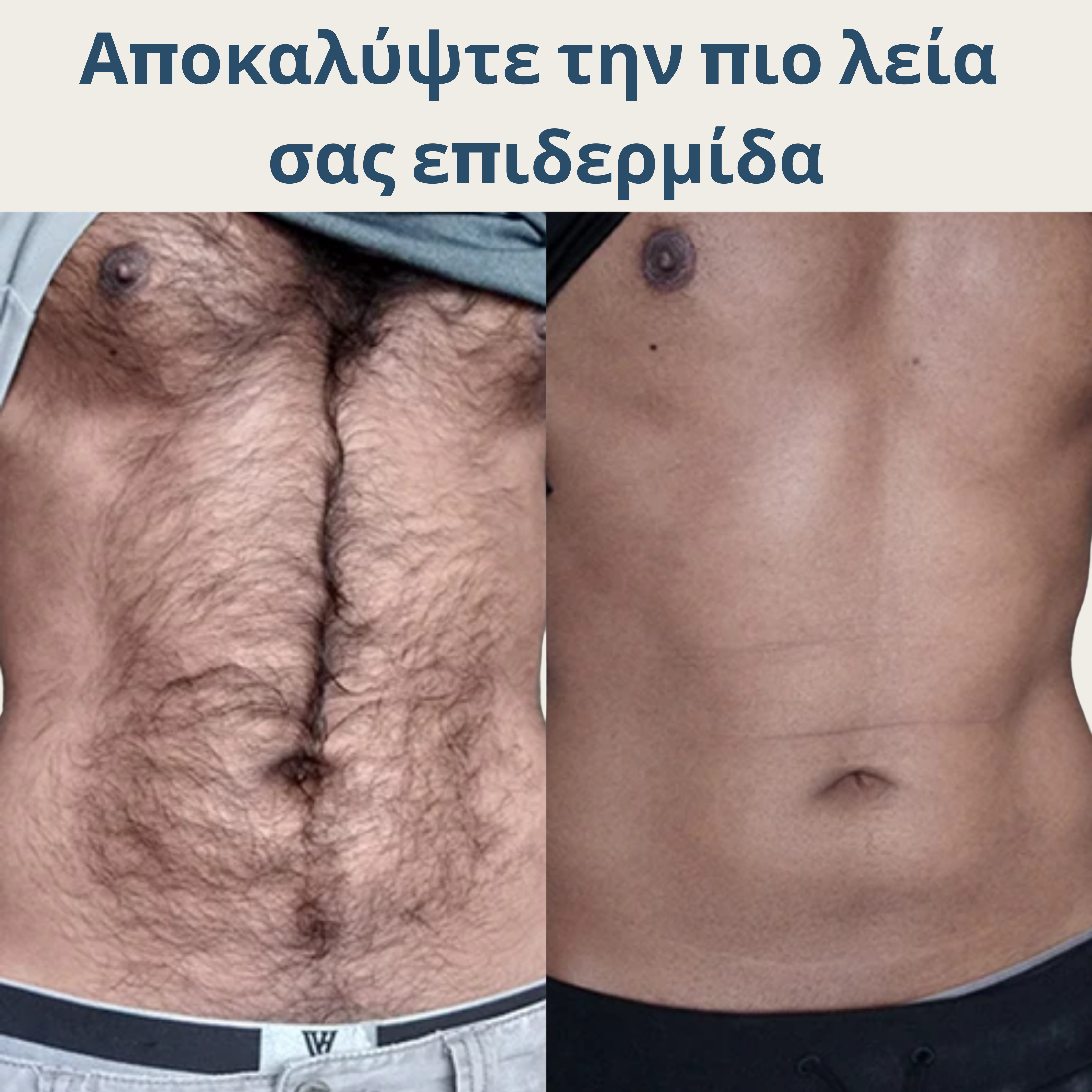 Σπρέι Αποτρίχωσης