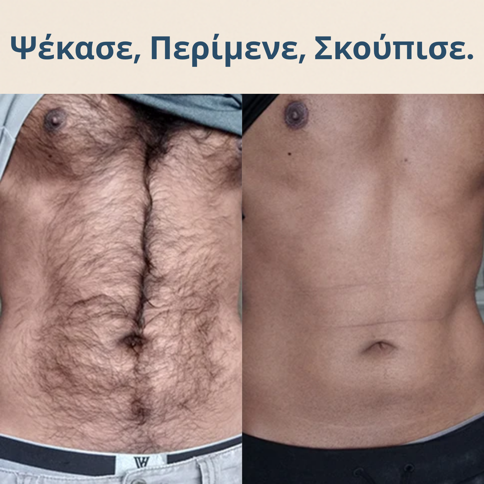 Σπρέι Αποτρίχωσης